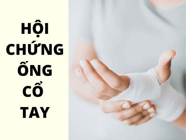 Hội chứng ống cổ tay trong tiếng Anh là gì?