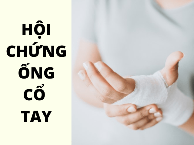 Hội chứng ống cổ tay tiếng anh là gì?