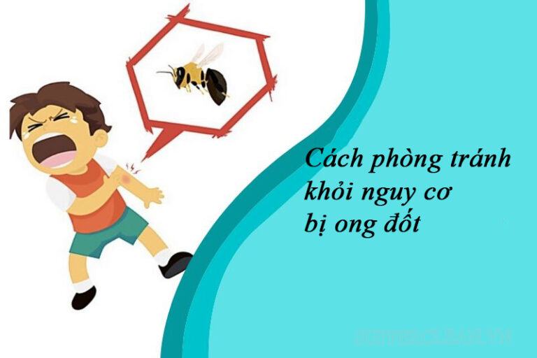 Bị ong đốt bôi gì? Mẹo xử lý khi bị ong đốt đơn giản tại nhà