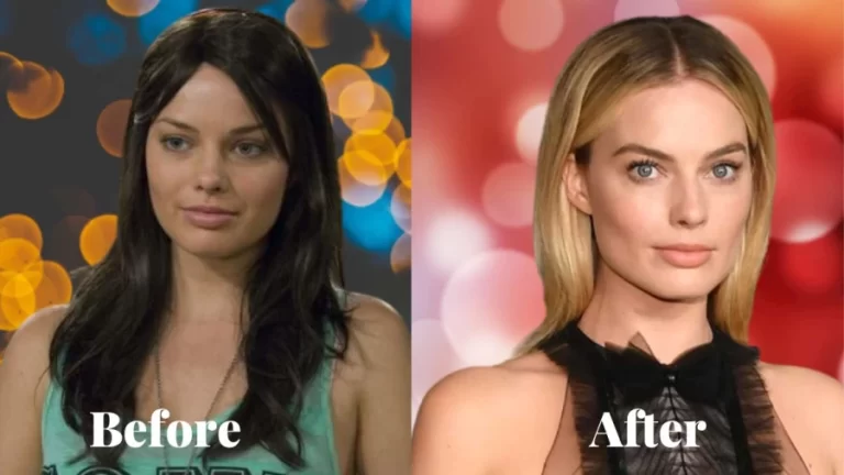 Margot Robbie Before and After Plastic Surgery Photo