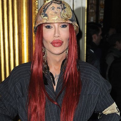 Pete Burns Sexuality: Was She Transgender? Transformation And Surgery ...